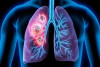 The Hidden Danger: How Air Pollution Messes with Your Lung Blood Vessels